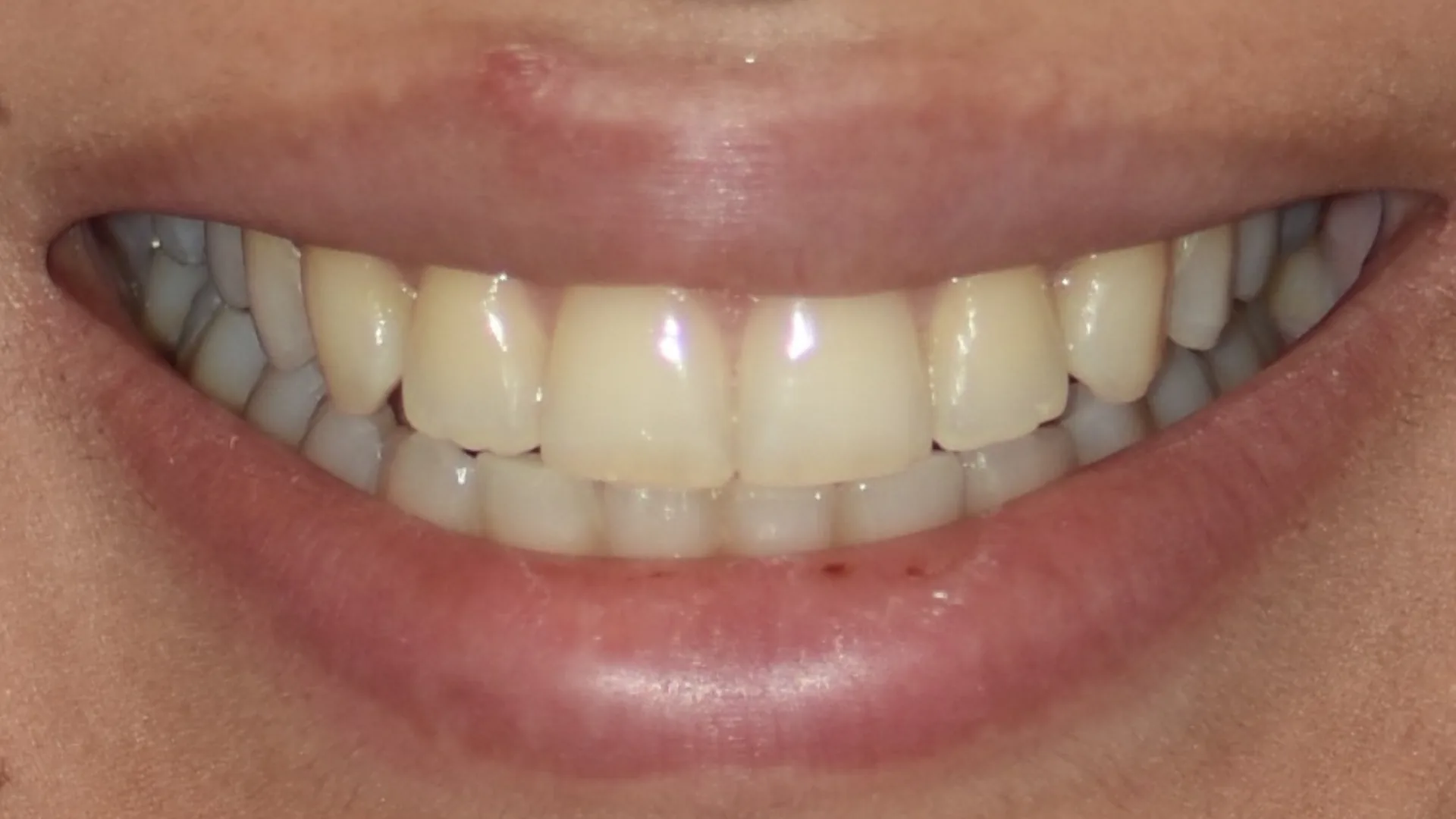 Before