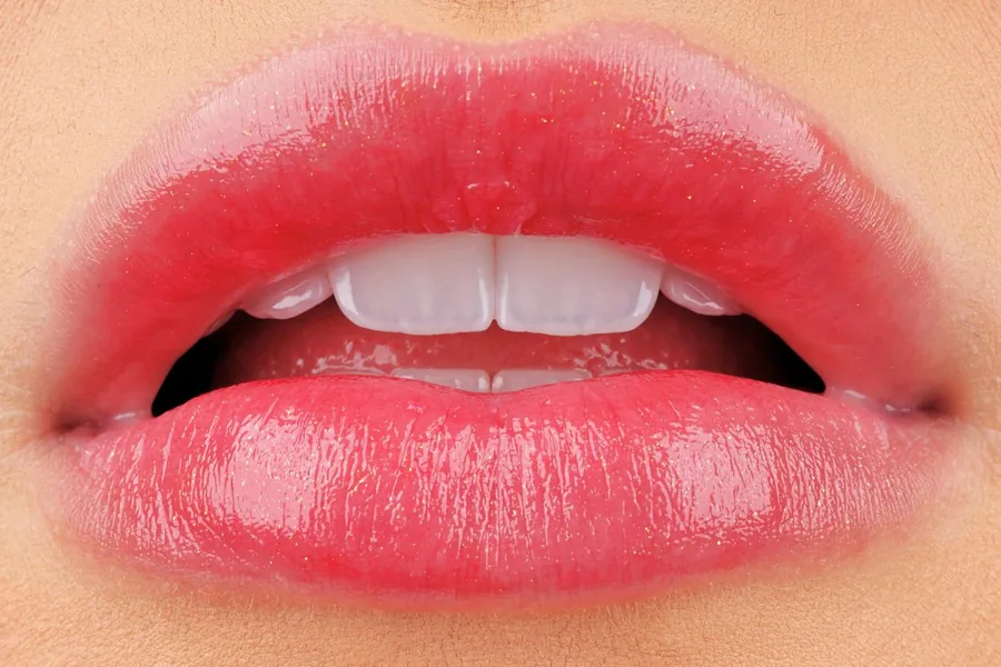 Anterior close-up: smile design result at Mineers