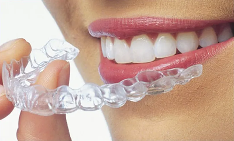 A clear aligner held in front of a smile