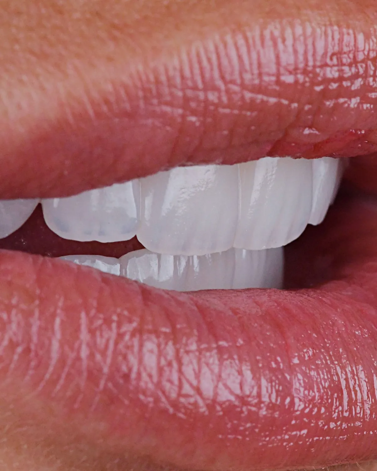 A bright, natural-looking smile, close up