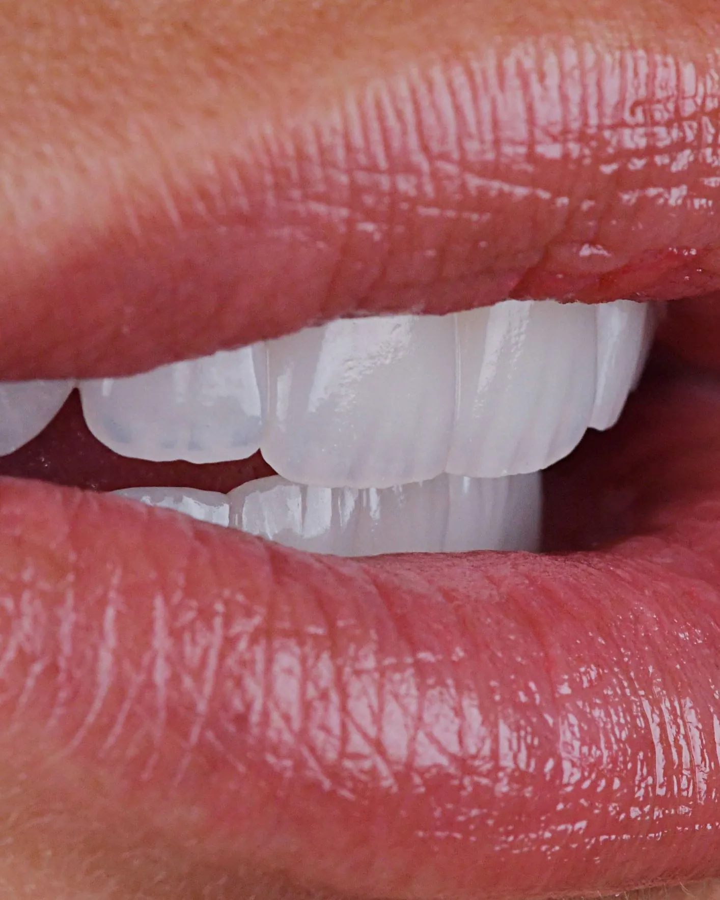 A smile, close up