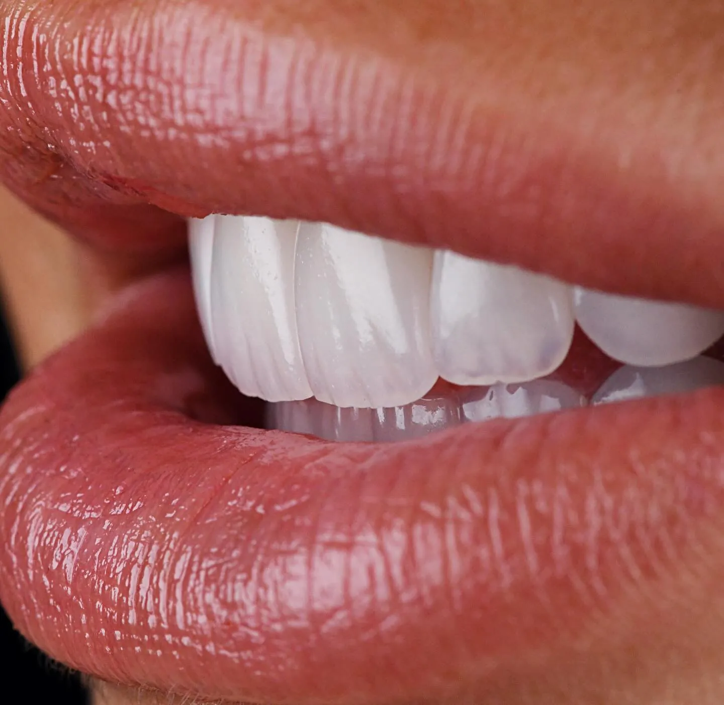 A smile, close up