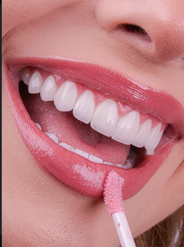 Composite veneers and a lip gloss wand