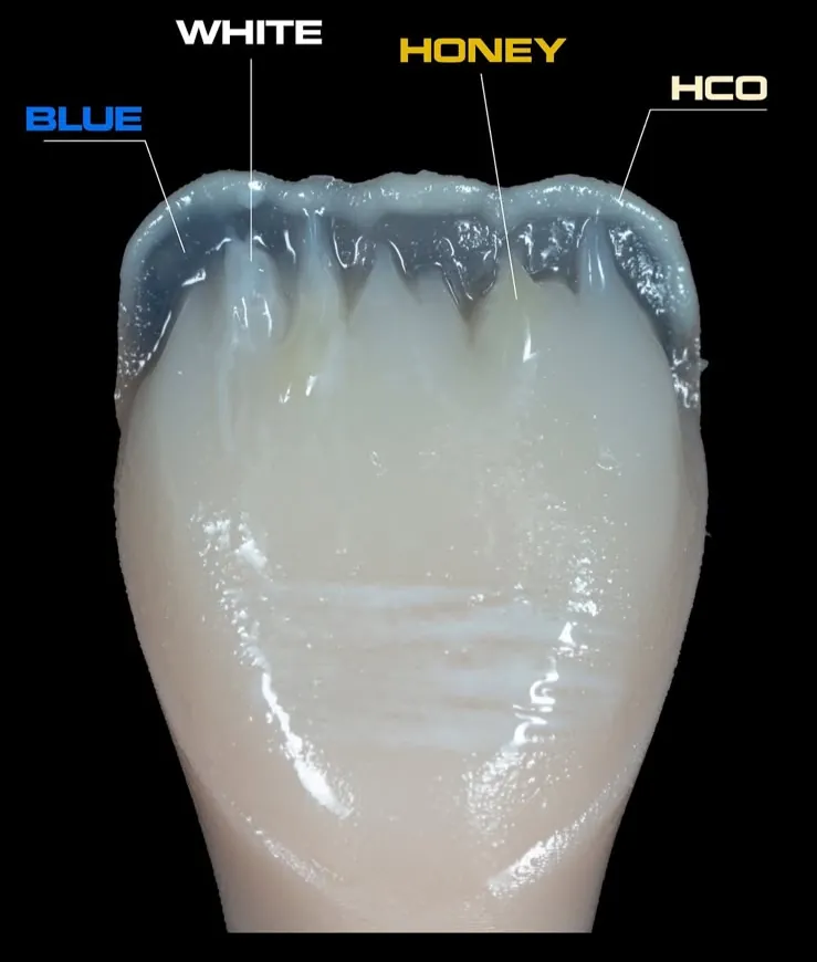 A shade map drawn over a front tooth