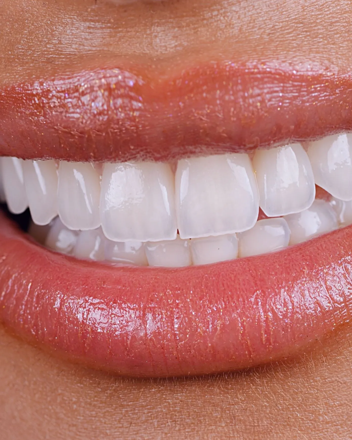 A smile, front on