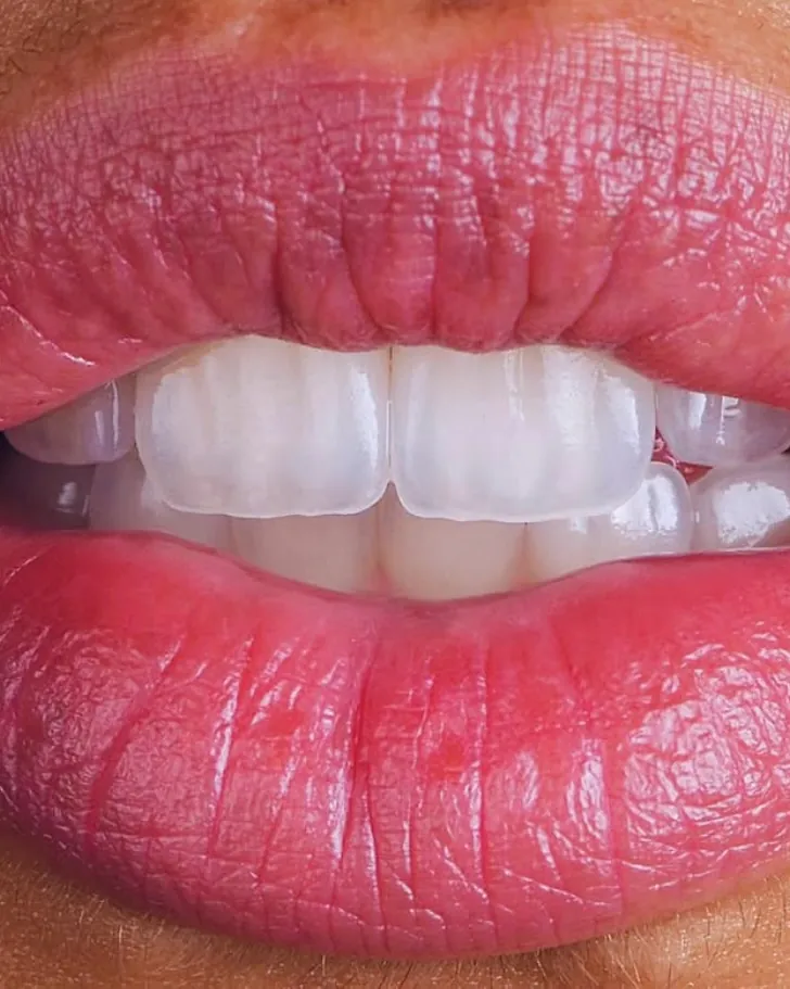 Front teeth, close up