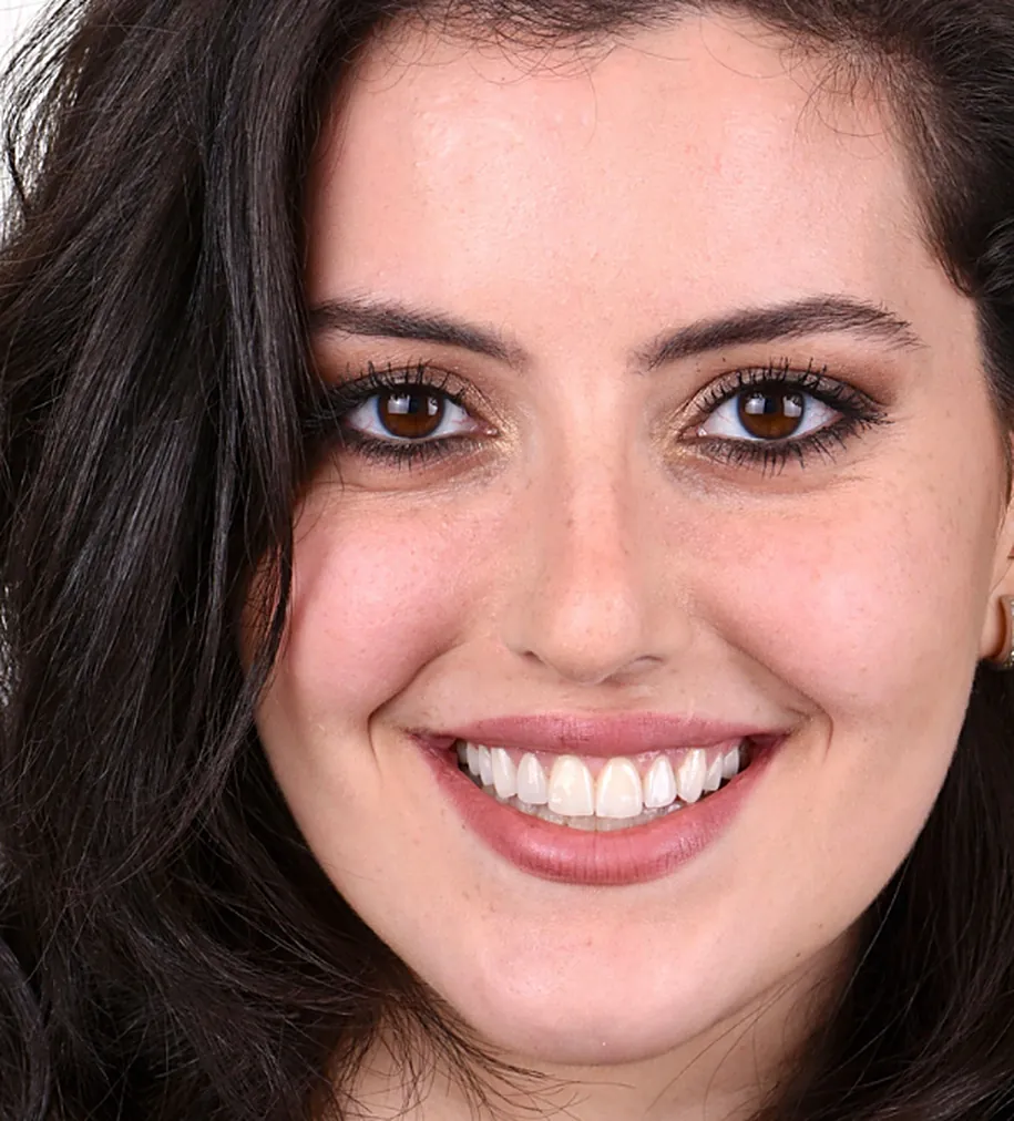 A smiling Mineers patient
