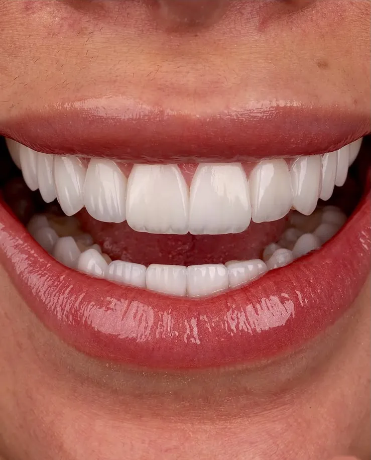 A healthy smile, close up