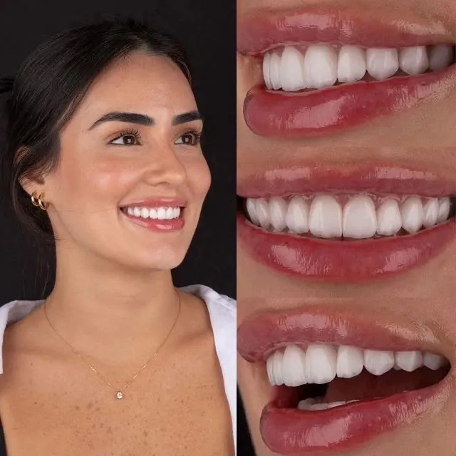 A woman smiling beside three close-ups of her teeth