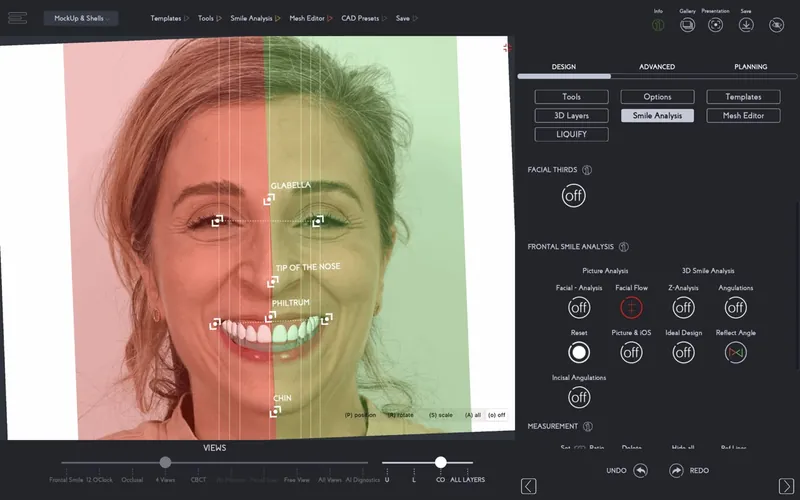 Smile design software marking the midline and smile line on a face
