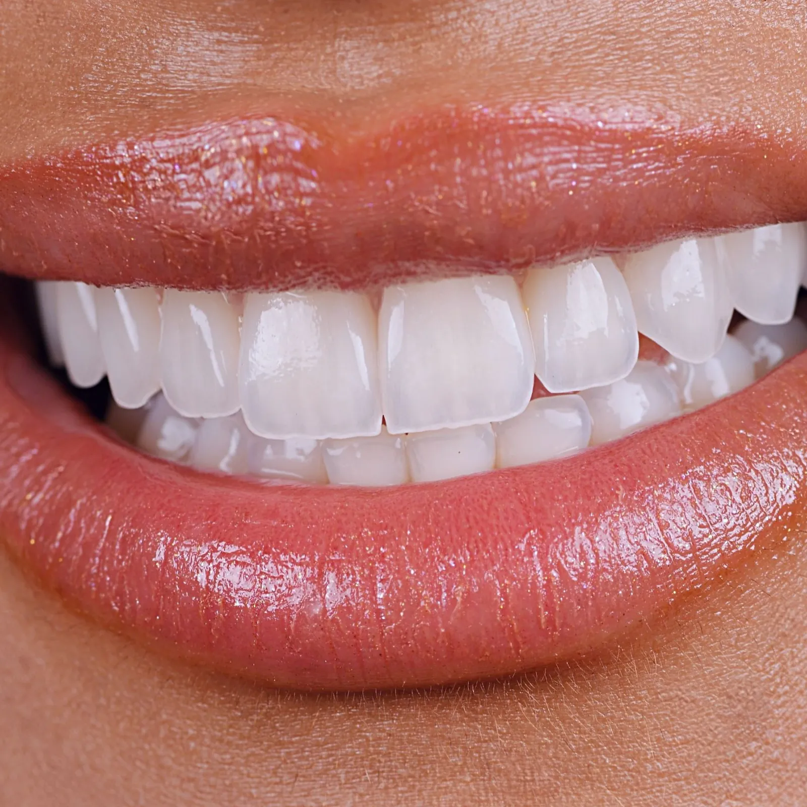 A close-up of a natural, even smile