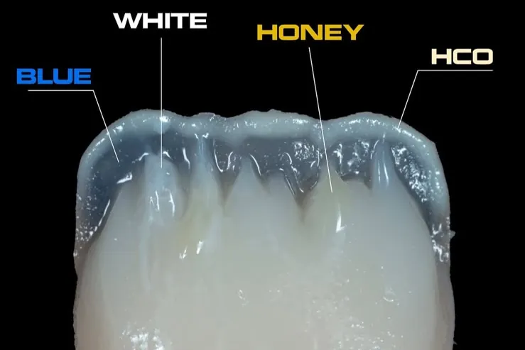 A tooth showing blue, white, honey and HCO enamel shades at its edge