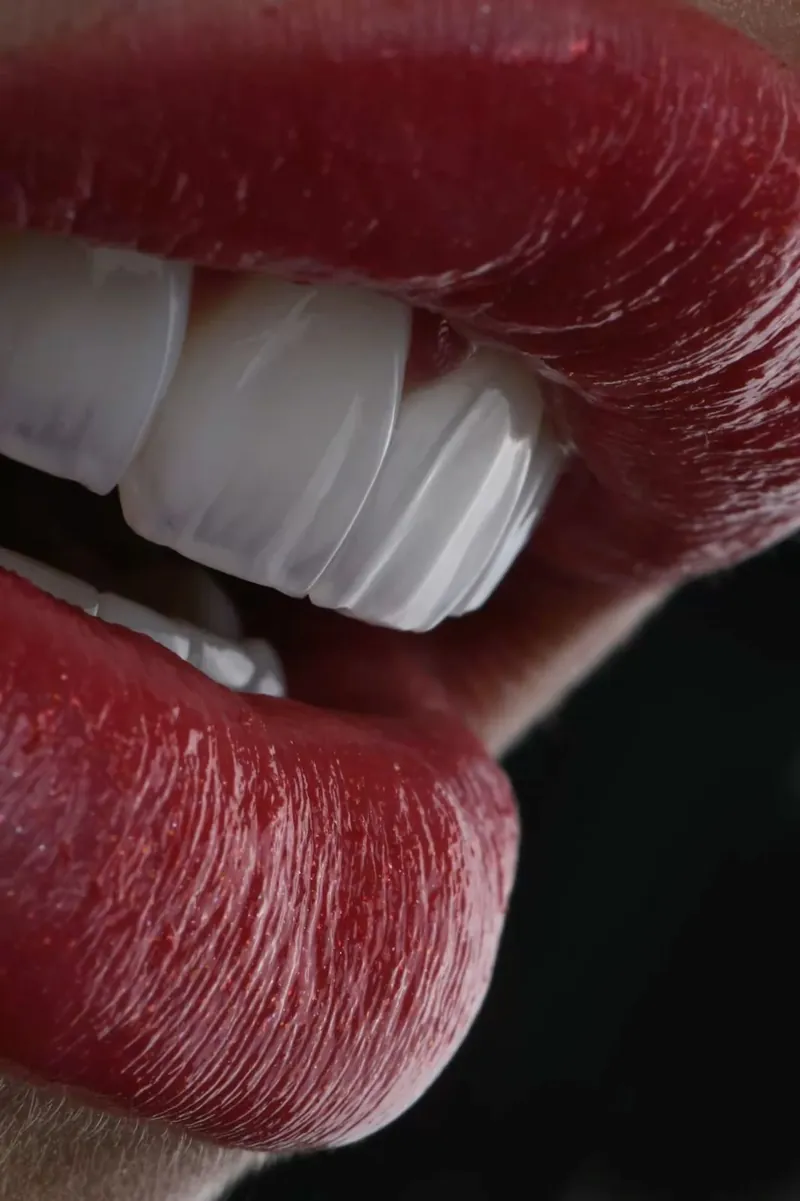 Veneers between red lips, close up