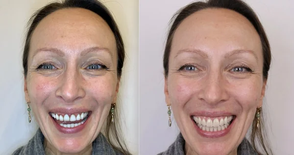 A patient’s photograph beside the smile designed for her