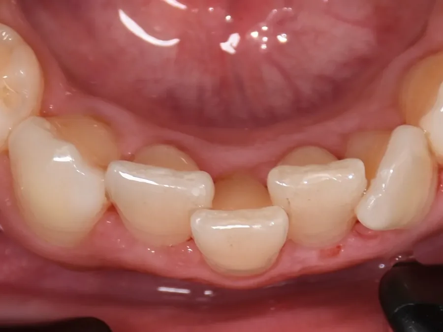 Case 20, before