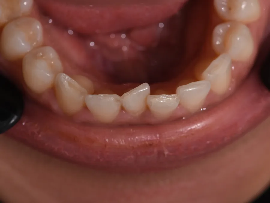 Case 21, before