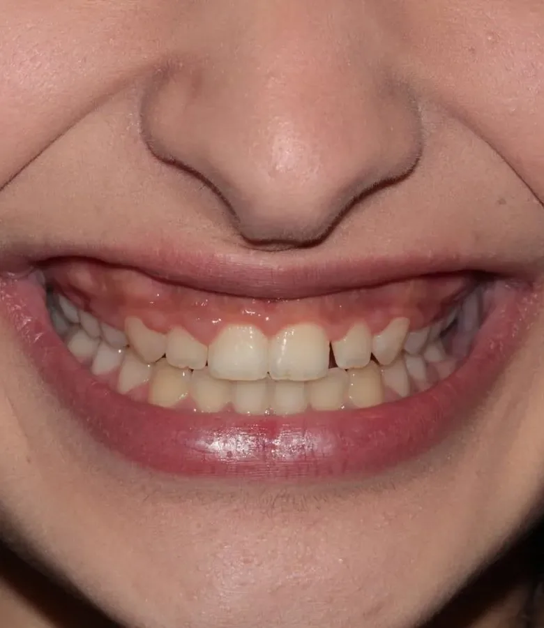 Case 26, before