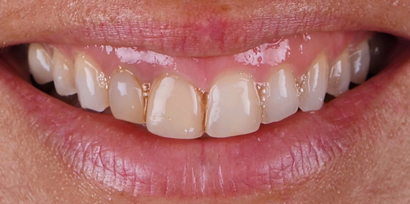 Case 01, before
