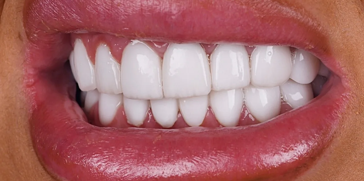 Case 02, before
