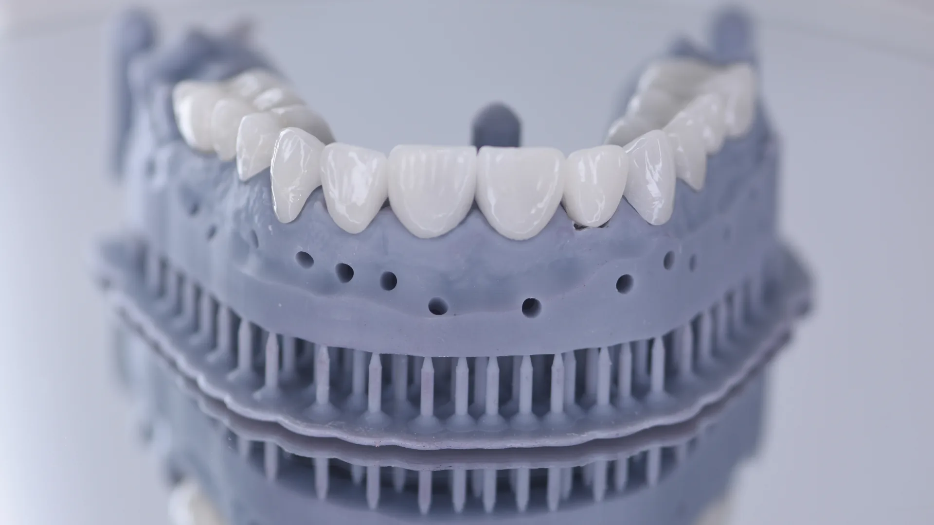Veneer showcase