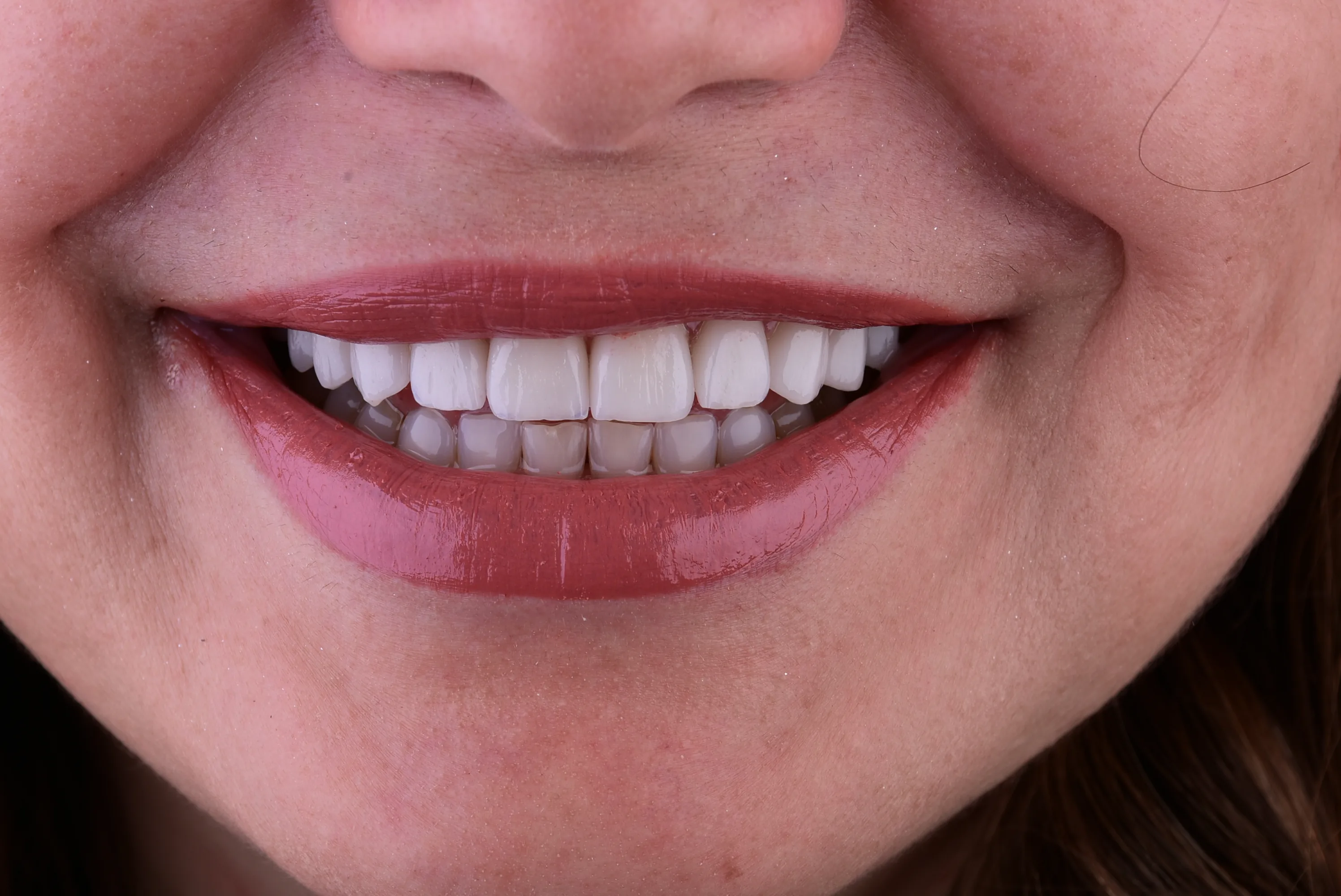 Veneer showcase